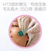 美容540微針滾輪MTS皮膚管理針ルーラー ニキビ跡スキンケア MICRONEEDLE 540 NEEDLS  